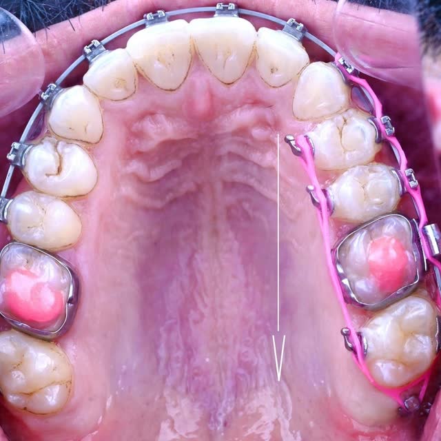 عمل سريري &mdash; صورة 64